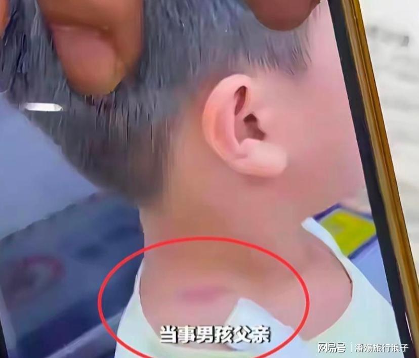 滇超联赛丨恭喜丽江！昆明，亚军！